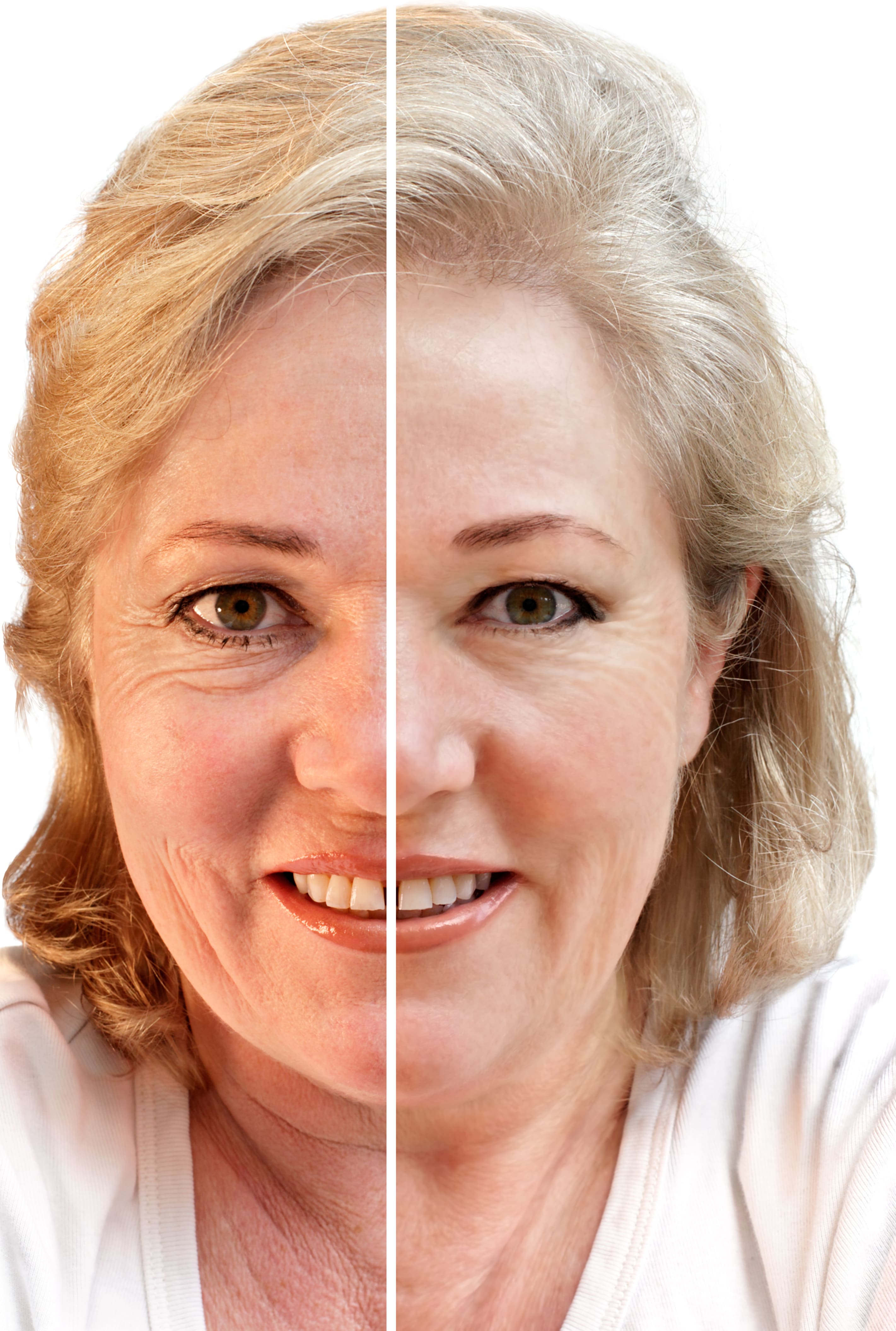 Skin Rejuvenation Treatment